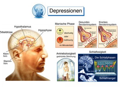 Antriebslosigkeit ade – Die besten Tipps gegen Antriebslosigkeit