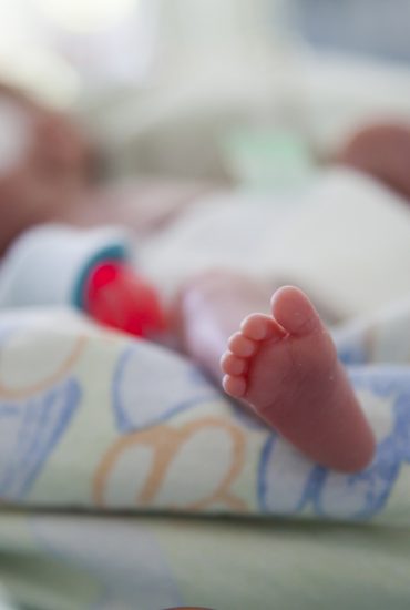 Dramatisches Ende: Baby ohne Nase ist nun gestorben