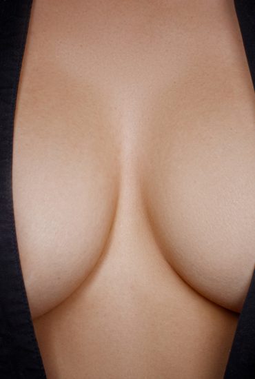 Brust-OP, Minirock und nackte Haut: Darf eine Mutter so sexy sein?